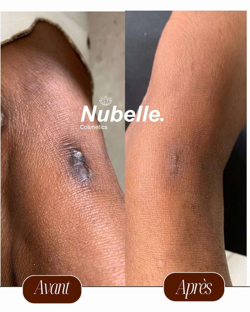 Publication Nubelle